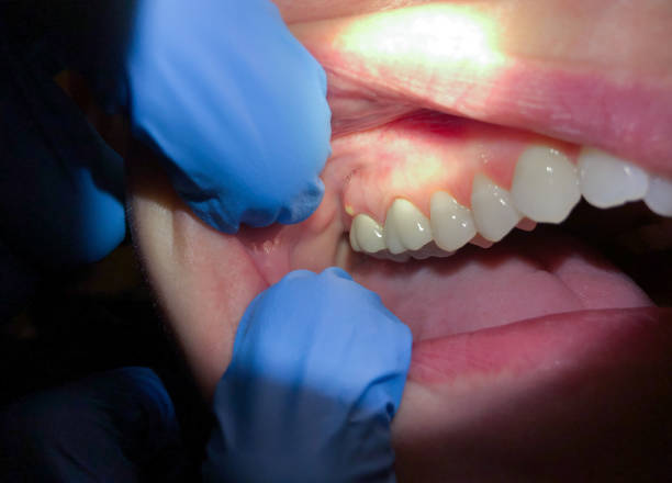 Best Broken or Cracked Tooth Emergency Dentist in Pulaski, WI